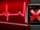 Apple Watch ne mesure pas bien votre fréquence cardiaque