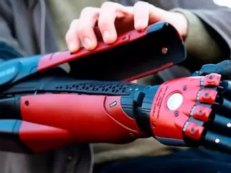bionic arm allows you to feel touch by connecting to the brain
