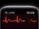 Apple Watch'ın EKG'si