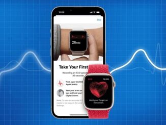 Smart watches with electrocardiogram and other extras